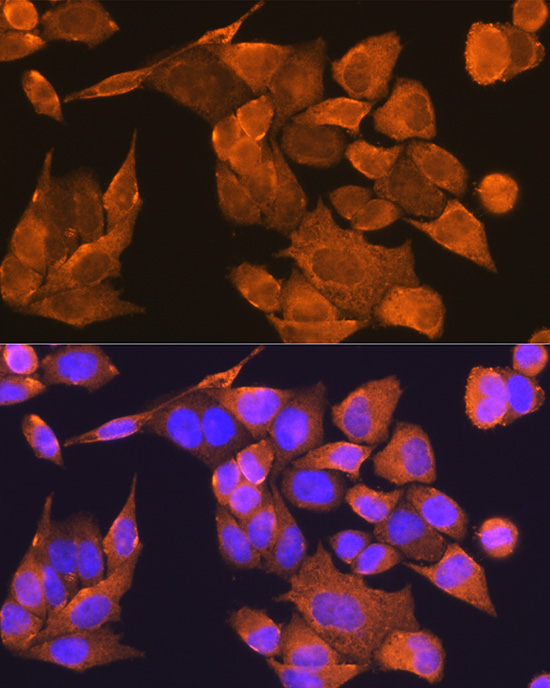 PFDN5 Rabbit polyclonal antibody