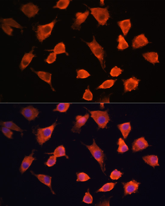 PFDN5 Rabbit polyclonal antibody