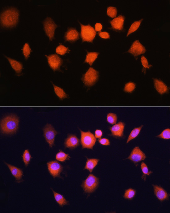 PGAM1 Rabbit polyclonal antibody