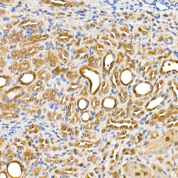 Thioredoxin 1 (Trx1/TXN) Rabbit monoclonal antibody