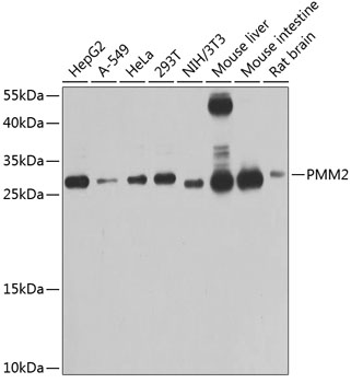 PMM2 Rabbit polyclonal antibody