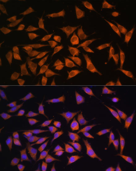 PMM2 Rabbit polyclonal antibody