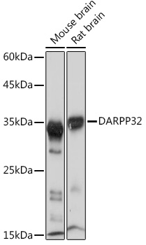 DARPP32 Rabbit mAb