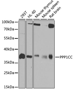 [KO Validated] PPP1CC Rabbit polyclonal antibody