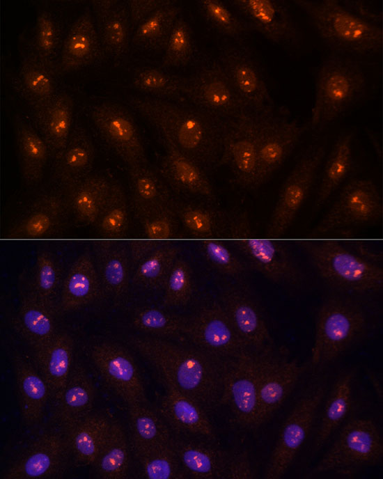 [KO Validated] PPP1CC Rabbit polyclonal antibody