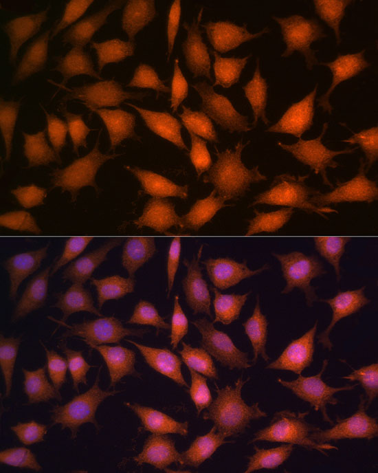 [KO Validated] PPP1CC Rabbit polyclonal antibody