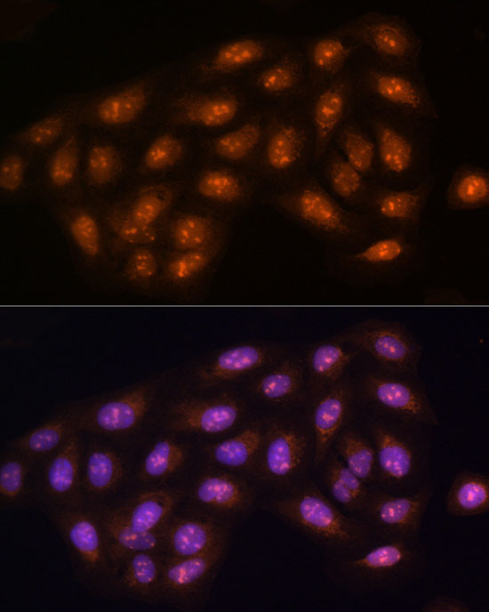 [KO Validated] PPP1CC Rabbit polyclonal antibody