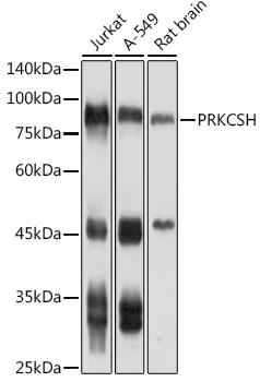 PRKCSH Rabbit polyclonal antibody