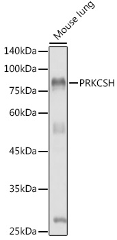 PRKCSH Rabbit polyclonal antibody