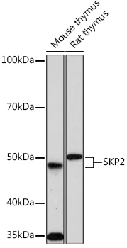 SKP2 Rabbit monoclonal antibody