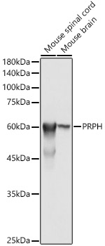 PRPH Rabbit polyclonal antibody