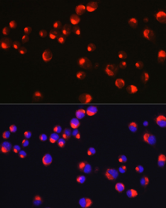 PRPH Rabbit polyclonal antibody