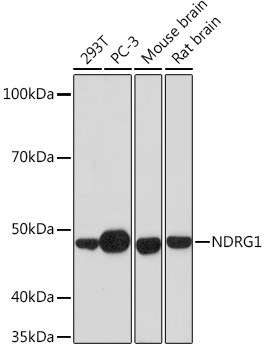 NDRG1 Rabbit monoclonal antibody