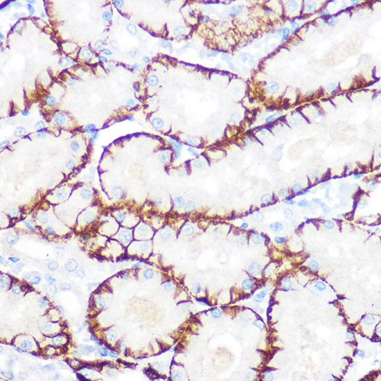 NDRG1 Rabbit monoclonal antibody
