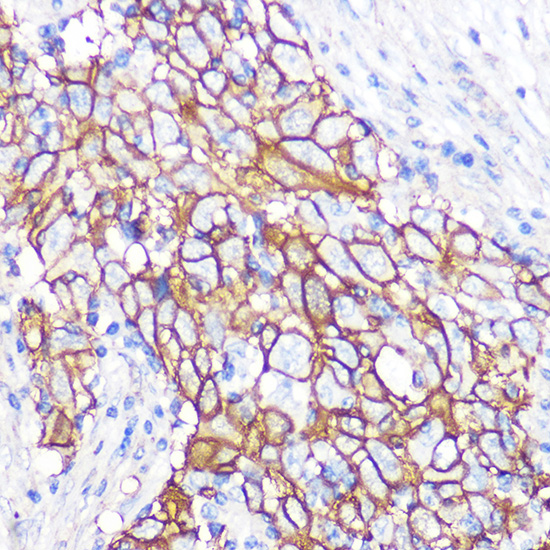 NDRG1 Rabbit monoclonal antibody
