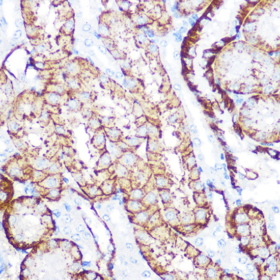 NDRG1 Rabbit monoclonal antibody