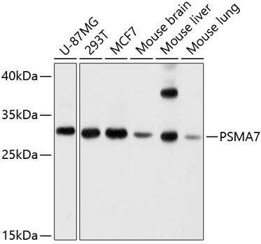 PSMA7 Rabbit polyclonal antibody