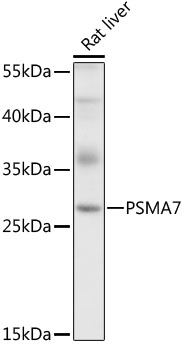 PSMA7 Rabbit polyclonal antibody