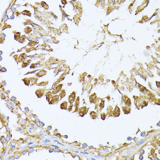 PSMA7 Rabbit polyclonal antibody