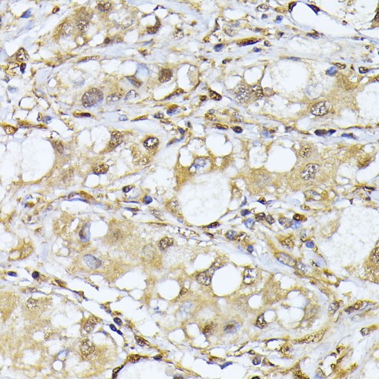 PSMA7 Rabbit polyclonal antibody