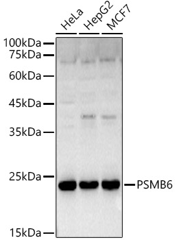 PSMB6 Rabbit polyclonal antibody