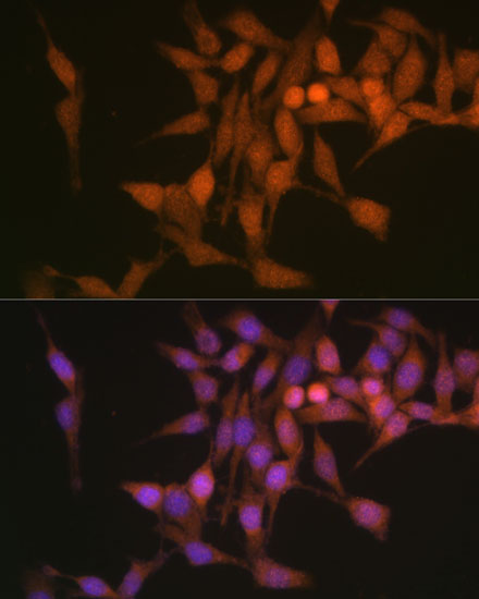 PSMB6 Rabbit polyclonal antibody
