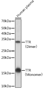 TTR Rabbit monoclonal antibody
