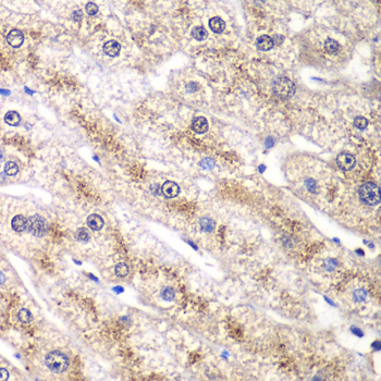 RALB Rabbit polyclonal antibody