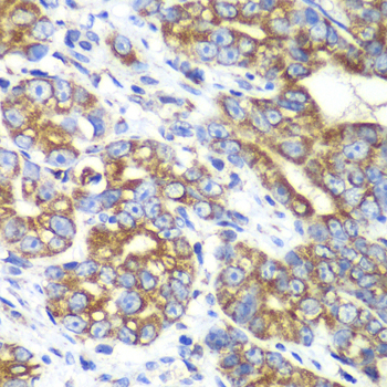 RALB Rabbit polyclonal antibody