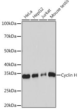 Cyclin H Rabbit monoclonal antibody