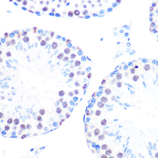 Cyclin H Rabbit monoclonal antibody