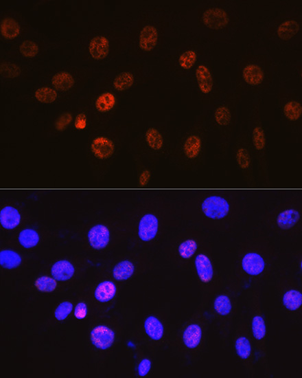 Cyclin H Rabbit monoclonal antibody