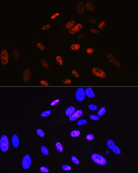 Cyclin H Rabbit monoclonal antibody