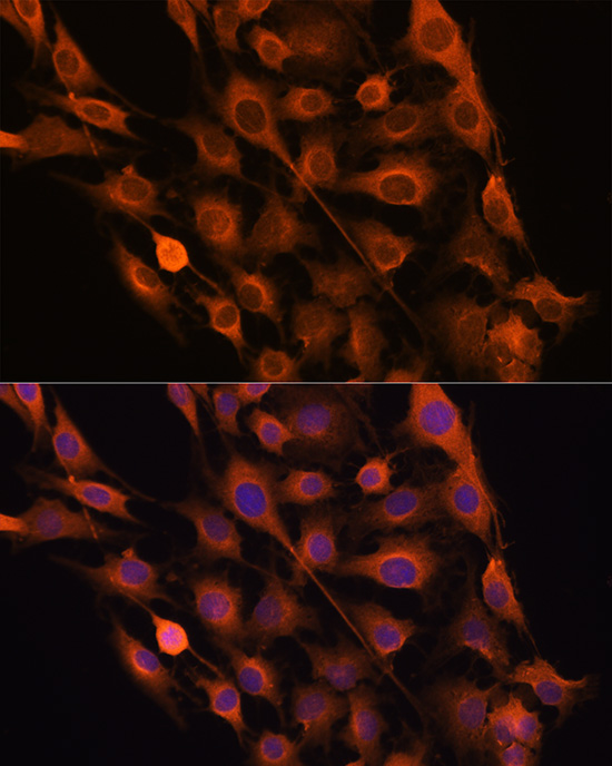 RNH1 Rabbit polyclonal antibody
