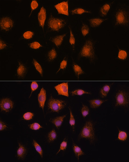 RNH1 Rabbit polyclonal antibody