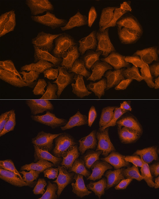RNH1 Rabbit polyclonal antibody