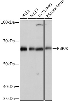 RBPJK Rabbit monoclonal antibody