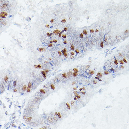 RBPJK Rabbit monoclonal antibody