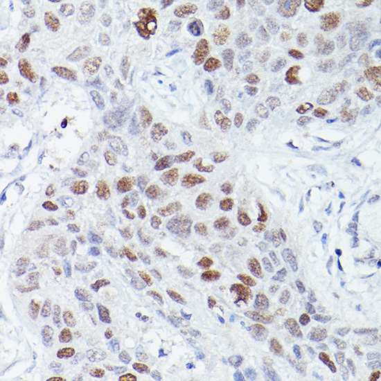RBPJK Rabbit monoclonal antibody
