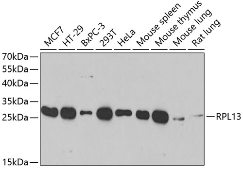 RPL13 Rabbit polyclonal antibody