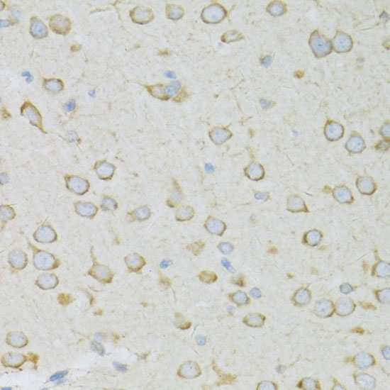 RPL13 Rabbit polyclonal antibody