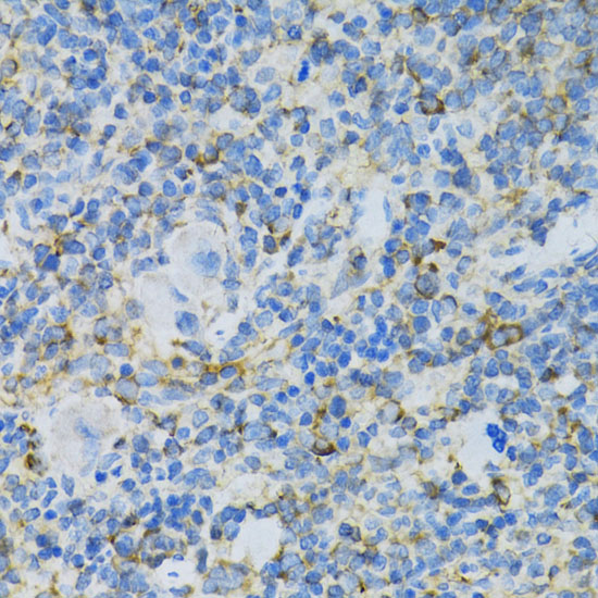RPL13 Rabbit polyclonal antibody