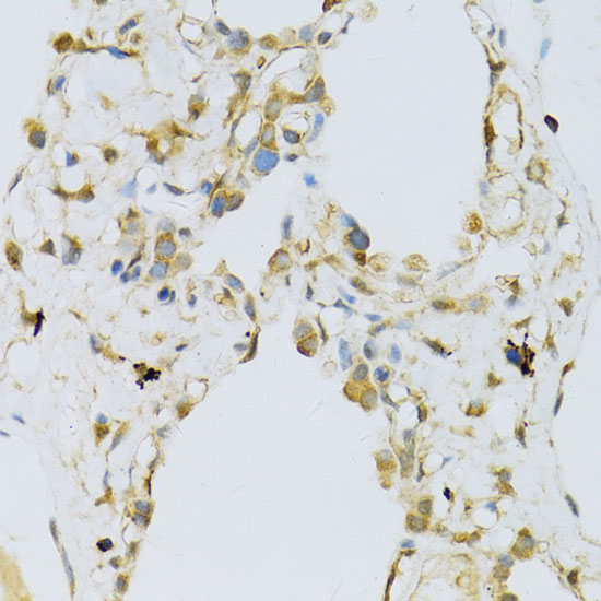 RPL13 Rabbit polyclonal antibody