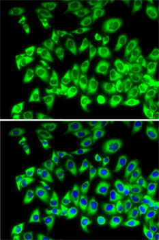 RPL13 Rabbit polyclonal antibody