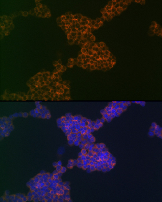 CD3G Rabbit monoclonal antibody