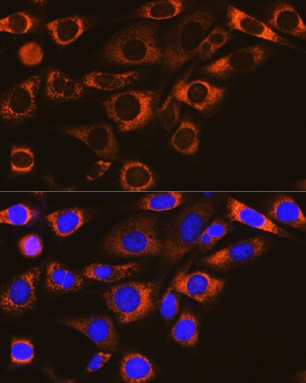FAAH1 Rabbit monoclonal antibody
