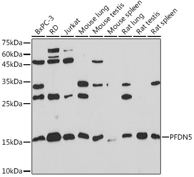 PFDN5 Rabbit monoclonal antibody