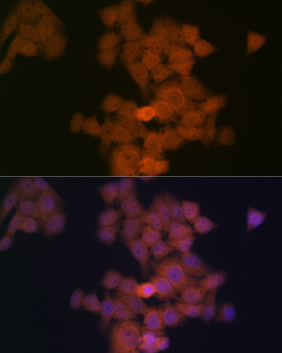 PFDN5 Rabbit monoclonal antibody