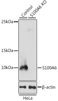 [KO Validated] S100A6 Rabbit polyclonal antibody