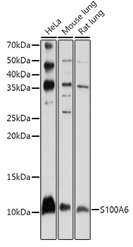 [KO Validated] S100A6 Rabbit polyclonal antibody
